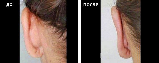 Отопластика. Гусляков 05: до и после – фото 8